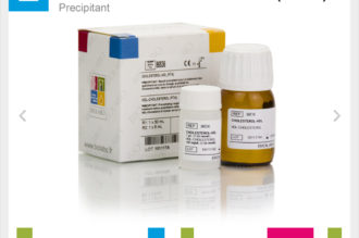 CHOLESTEROL-HDL (PTA) Precipitant